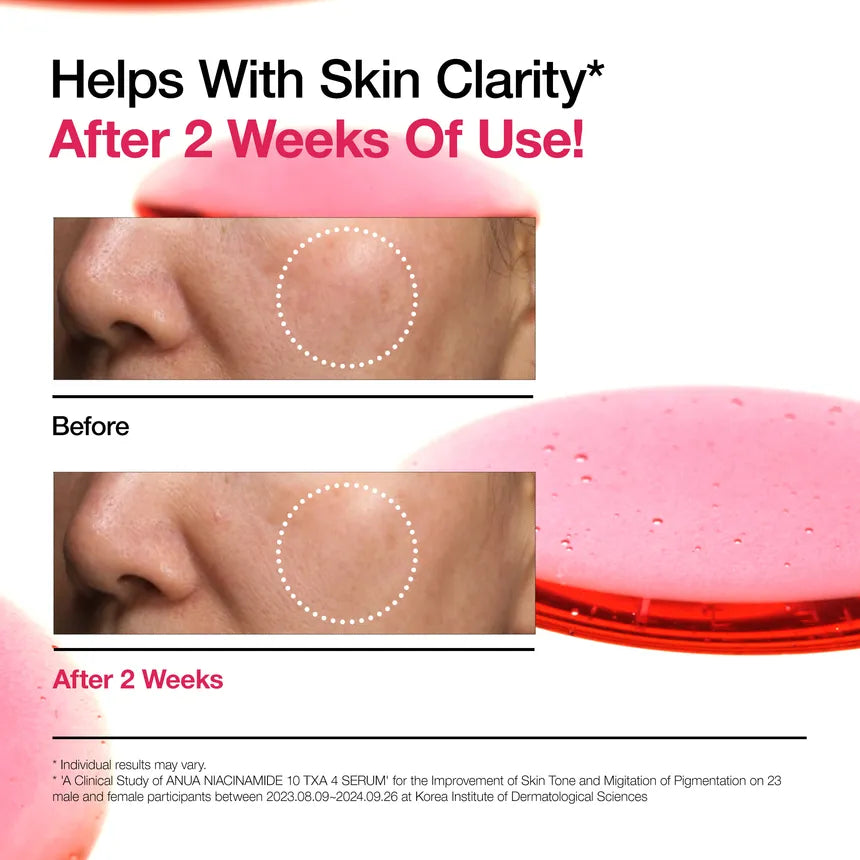 Anua - Niacinamide 10 TXA 4 Serum